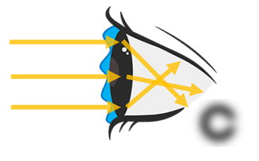 ドライアイの症状