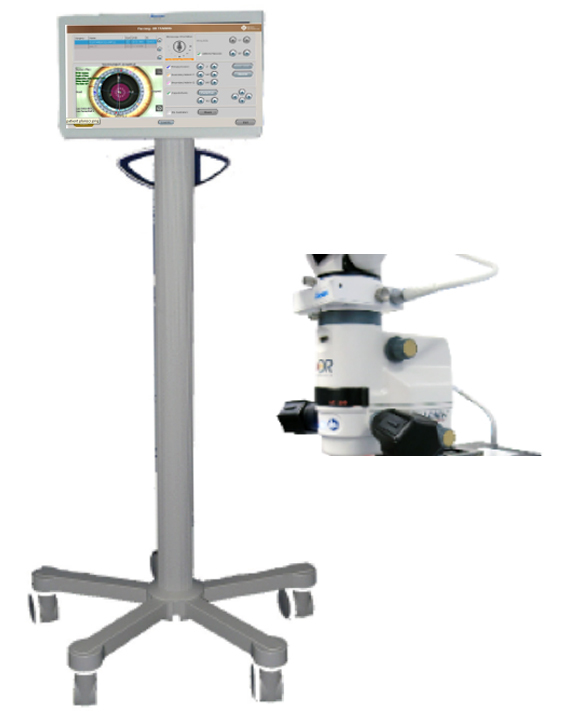 白内障手術ガイドシステム